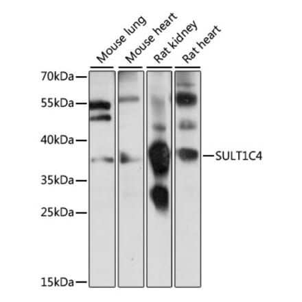 Western Blot - Anti-SULT1C4 Antibody (A89484) - Antibodies.com