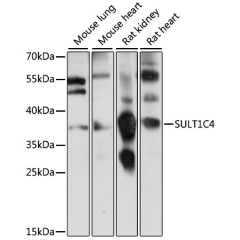 Western Blot - Anti-SULT1C4 Antibody (A89484) - Antibodies.com