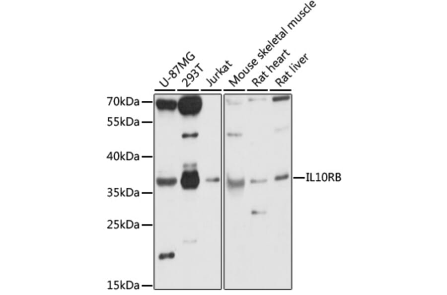 Western Blot - Anti-IL-10RB/IL-10R2 Antibody (A89485) - Antibodies.com