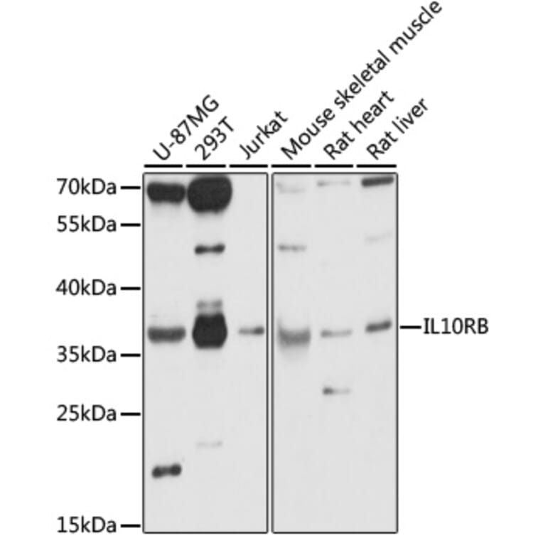 Western Blot - Anti-IL-10RB/IL-10R2 Antibody (A89485) - Antibodies.com