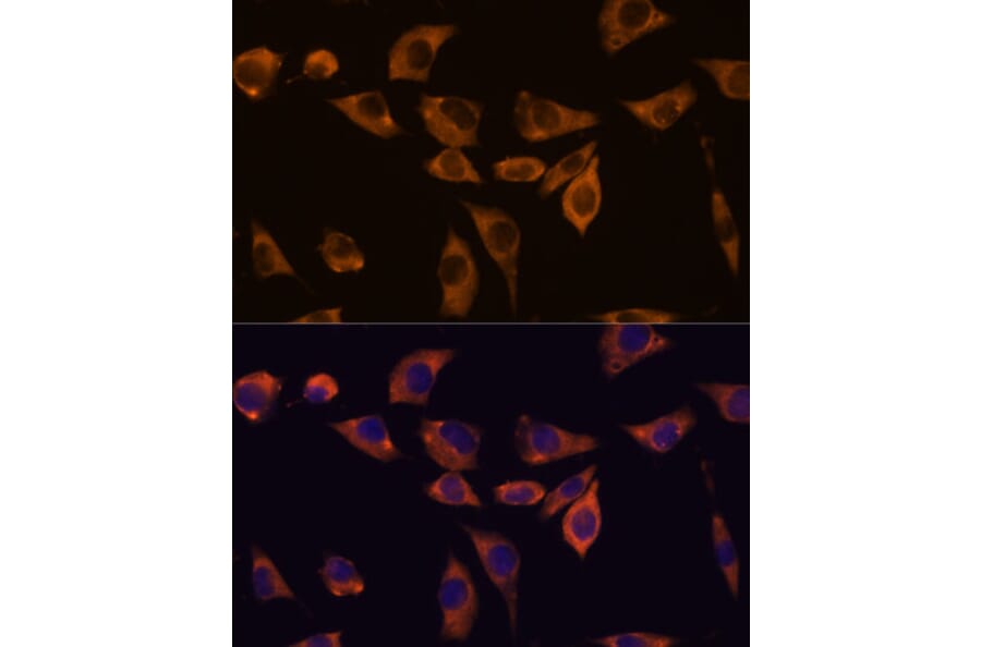 Immunofluorescence - Anti-IL-10RB/IL-10R2 Antibody (A89485) - Antibodies.com
