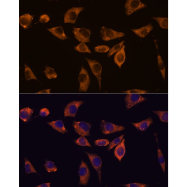 Immunofluorescence - Anti-IL-10RB/IL-10R2 Antibody (A89485) - Antibodies.com