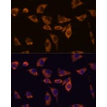 Immunofluorescence - Anti-IL-10RB/IL-10R2 Antibody (A89485) - Antibodies.com