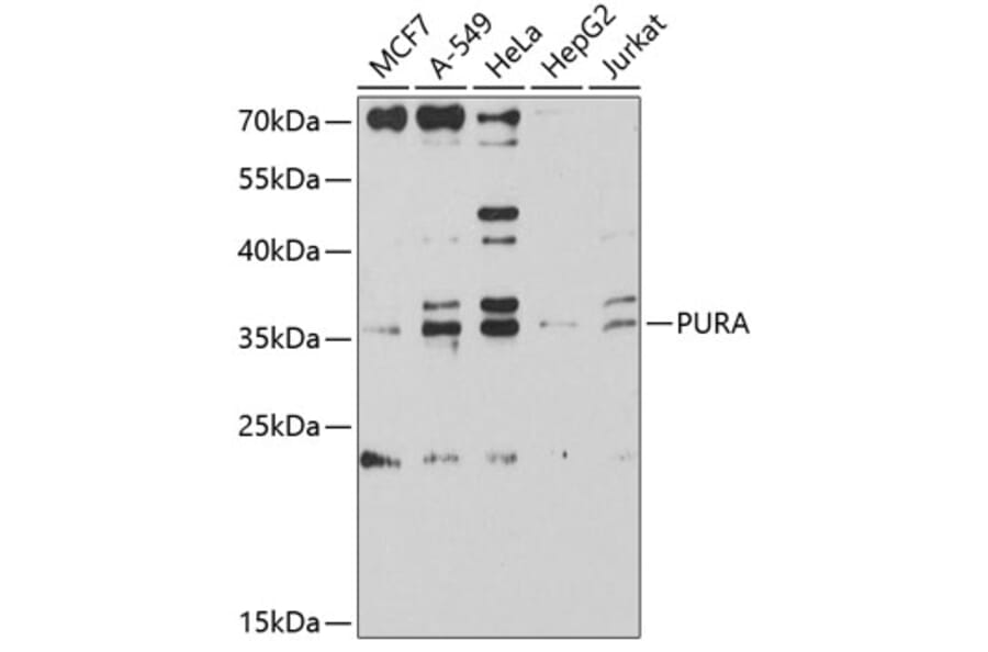 Western Blot - Anti-PURA Antibody (A9296) - Antibodies.com