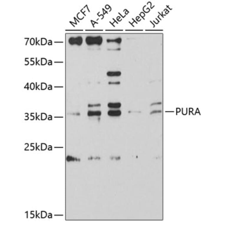 Western Blot - Anti-PURA Antibody (A9296) - Antibodies.com