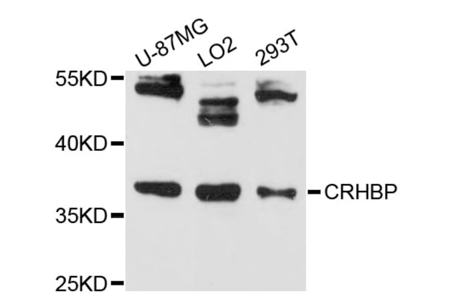 Western Blot - Anti-CRHBP Antibody (A13027) - Antibodies.com
