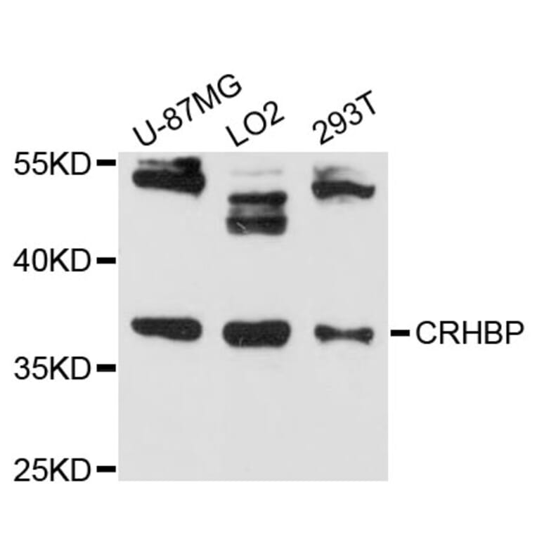 Western Blot - Anti-CRHBP Antibody (A13027) - Antibodies.com
