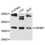 Western Blot - Anti-CRHBP Antibody (A13027) - Antibodies.com