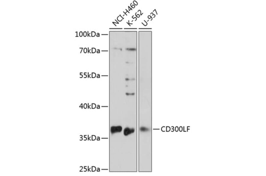 Western Blot - Anti-CD300 Antibody (A89488) - Antibodies.com