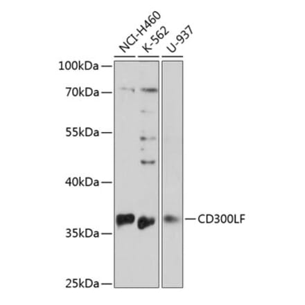 Western Blot - Anti-CD300 Antibody (A89488) - Antibodies.com