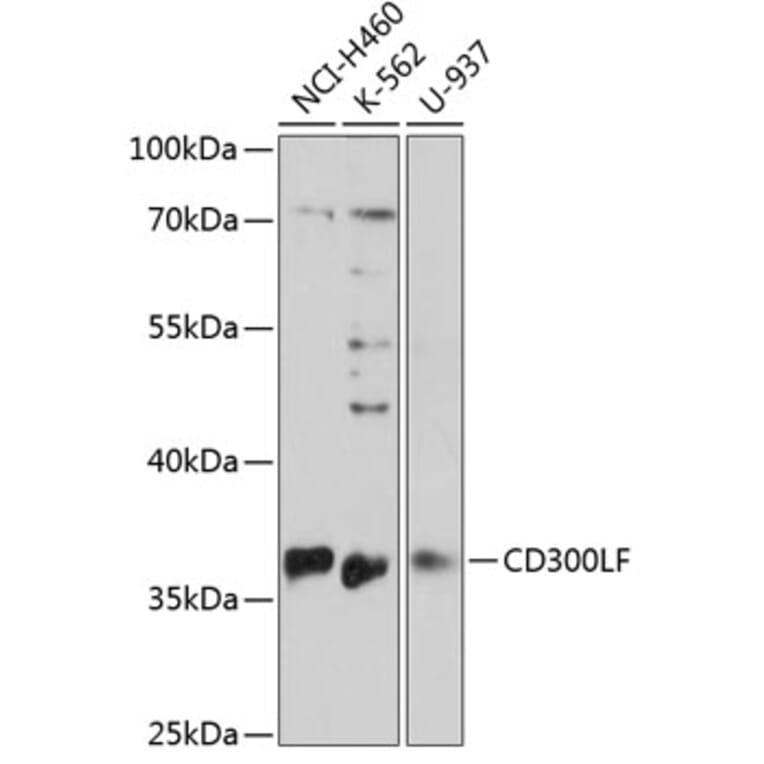 Western Blot - Anti-CD300 Antibody (A89488) - Antibodies.com