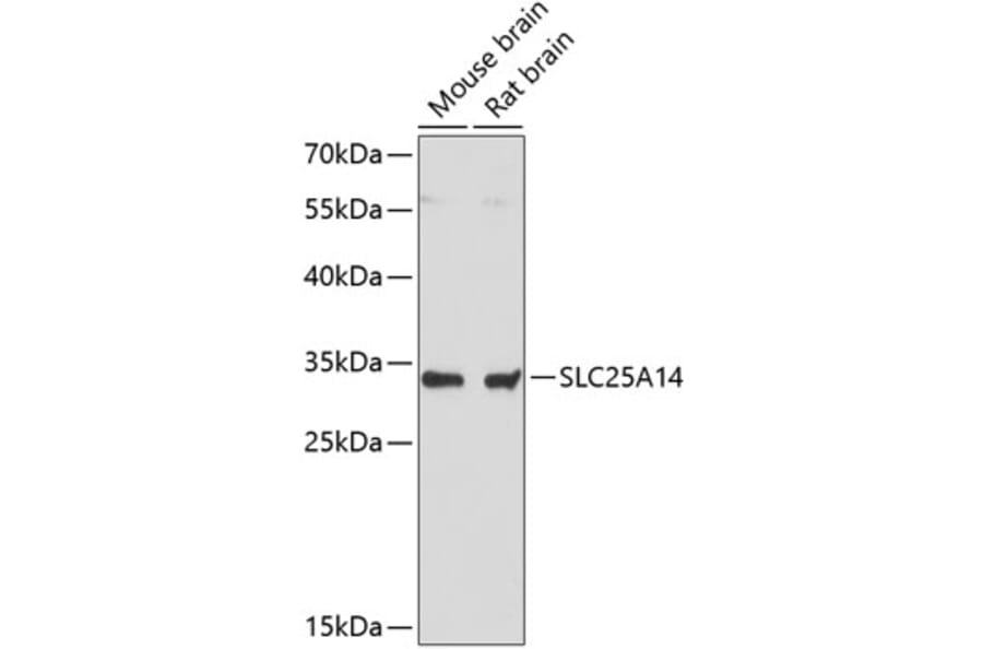 Western Blot - Anti-UCP5 Antibody (A89489) - Antibodies.com
