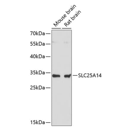 Western Blot - Anti-UCP5 Antibody (A89489) - Antibodies.com