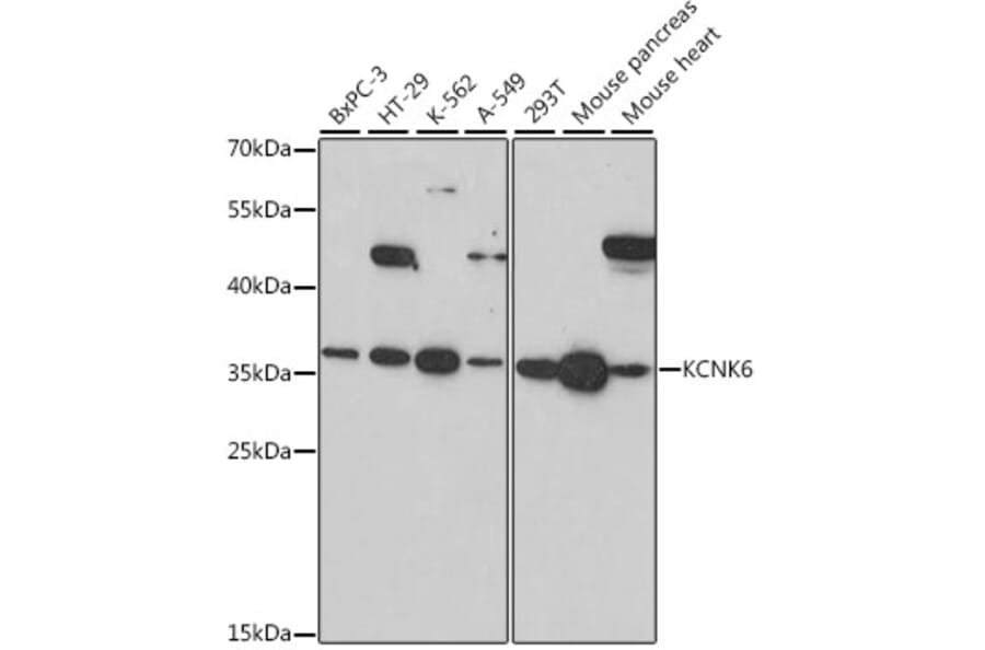 Western Blot - Anti-KCNK6 Antibody (A89490) - Antibodies.com