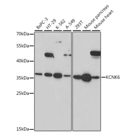 Western Blot - Anti-KCNK6 Antibody (A89490) - Antibodies.com
