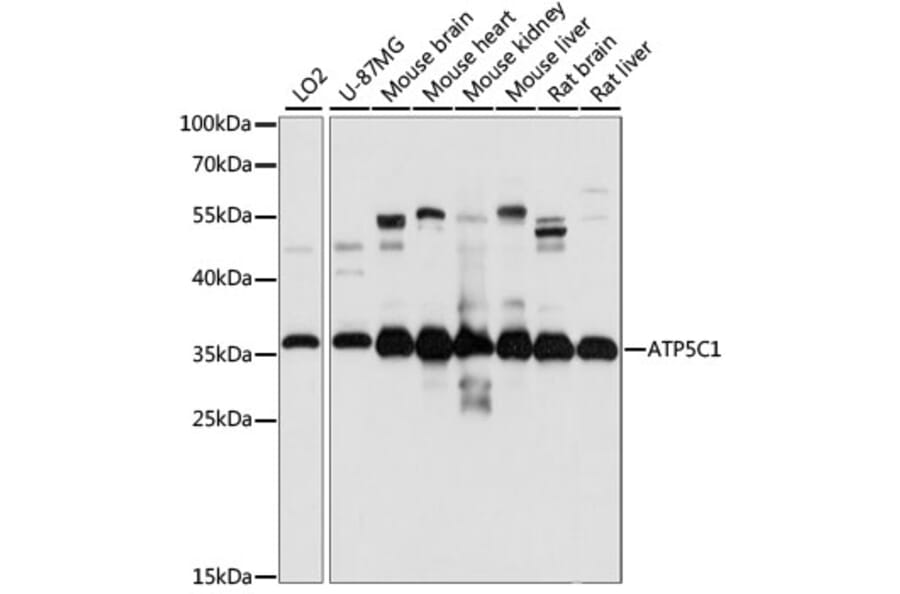 Western Blot - Anti-ATP5C1 Antibody (A89491) - Antibodies.com