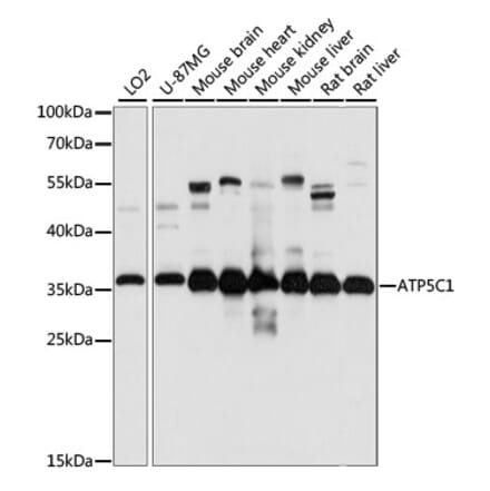 Western Blot - Anti-ATP5C1 Antibody (A89491) - Antibodies.com