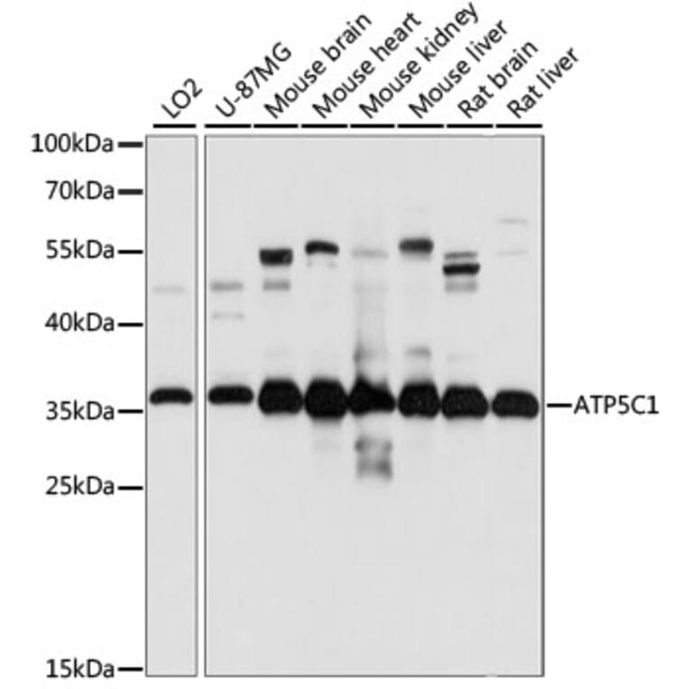 Western Blot - Anti-ATP5C1 Antibody (A89491) - Antibodies.com
