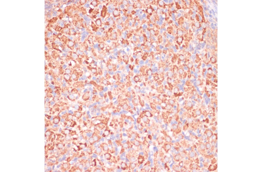 Immunohistochemistry - Anti-ATP5C1 Antibody (A89491) - Antibodies.com