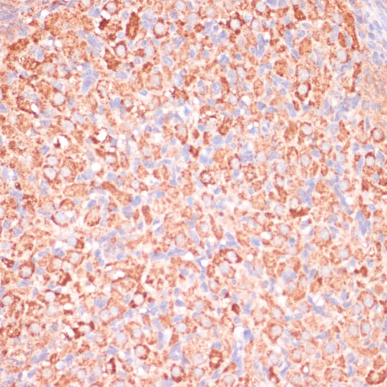 Immunohistochemistry - Anti-ATP5C1 Antibody (A89491) - Antibodies.com