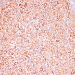 Immunohistochemistry - Anti-ATP5C1 Antibody (A89491) - Antibodies.com