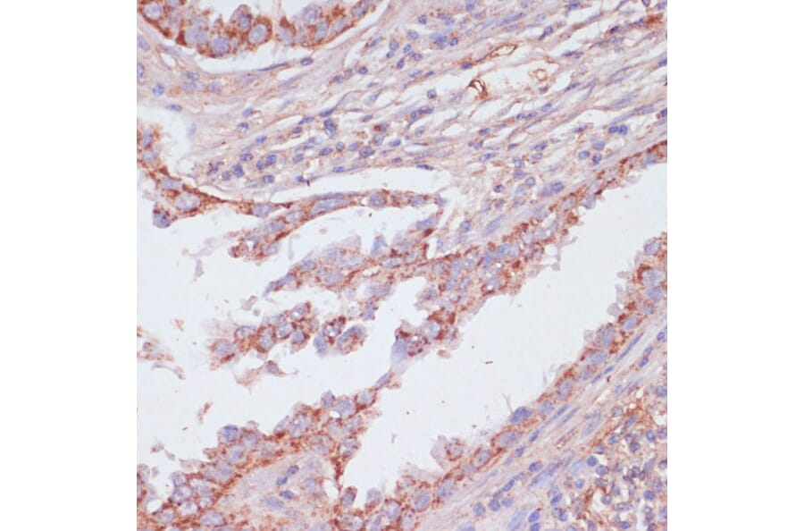 Immunohistochemistry - Anti-ATP5C1 Antibody (A89491) - Antibodies.com