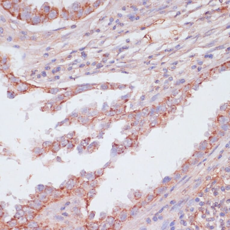 Immunohistochemistry - Anti-ATP5C1 Antibody (A89491) - Antibodies.com