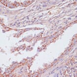 Immunohistochemistry - Anti-ATP5C1 Antibody (A89491) - Antibodies.com