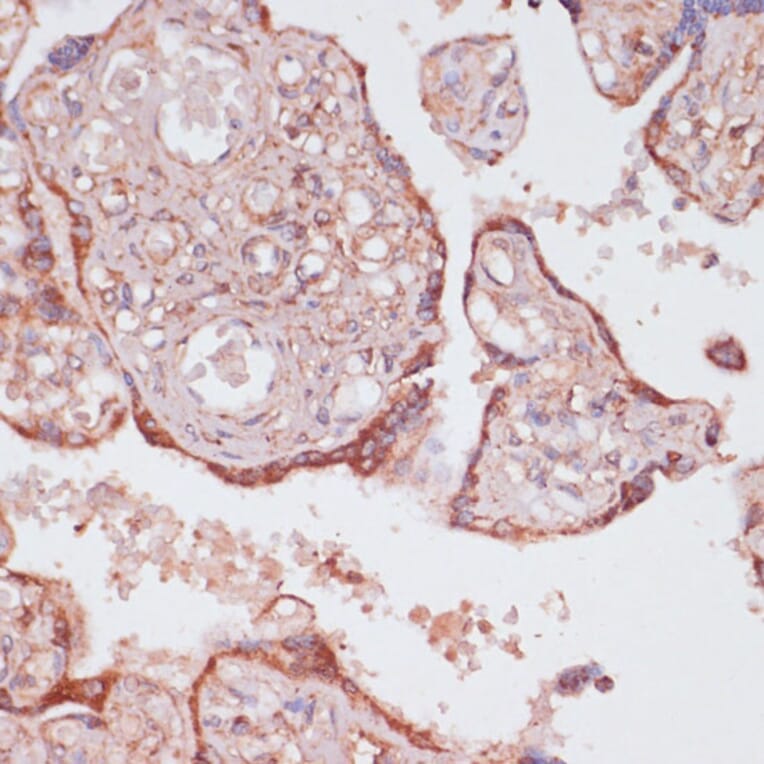 Immunohistochemistry - Anti-ATP5C1 Antibody (A89491) - Antibodies.com