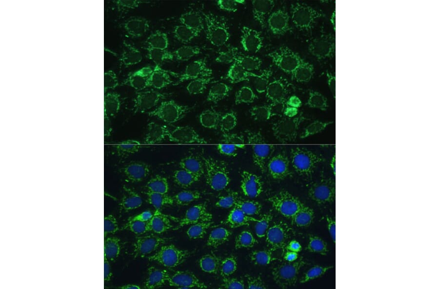 Immunofluorescence - Anti-ATP5C1 Antibody (A89491) - Antibodies.com