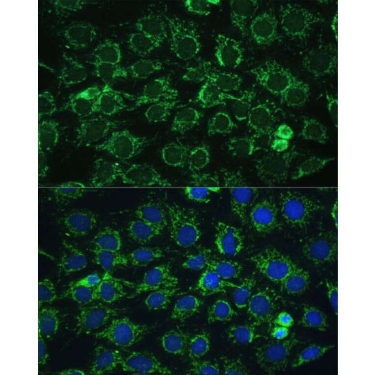 Immunofluorescence - Anti-ATP5C1 Antibody (A89491) - Antibodies.com