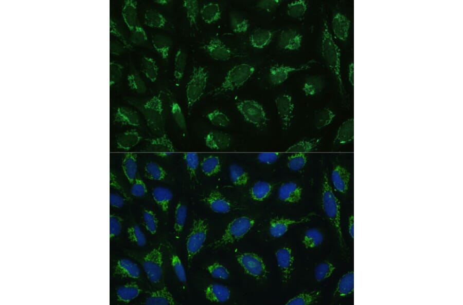 Immunofluorescence - Anti-ATP5C1 Antibody (A89491) - Antibodies.com