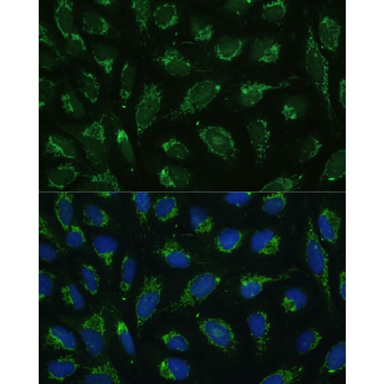 Immunofluorescence - Anti-ATP5C1 Antibody (A89491) - Antibodies.com