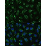 Immunofluorescence - Anti-ATP5C1 Antibody (A89491) - Antibodies.com