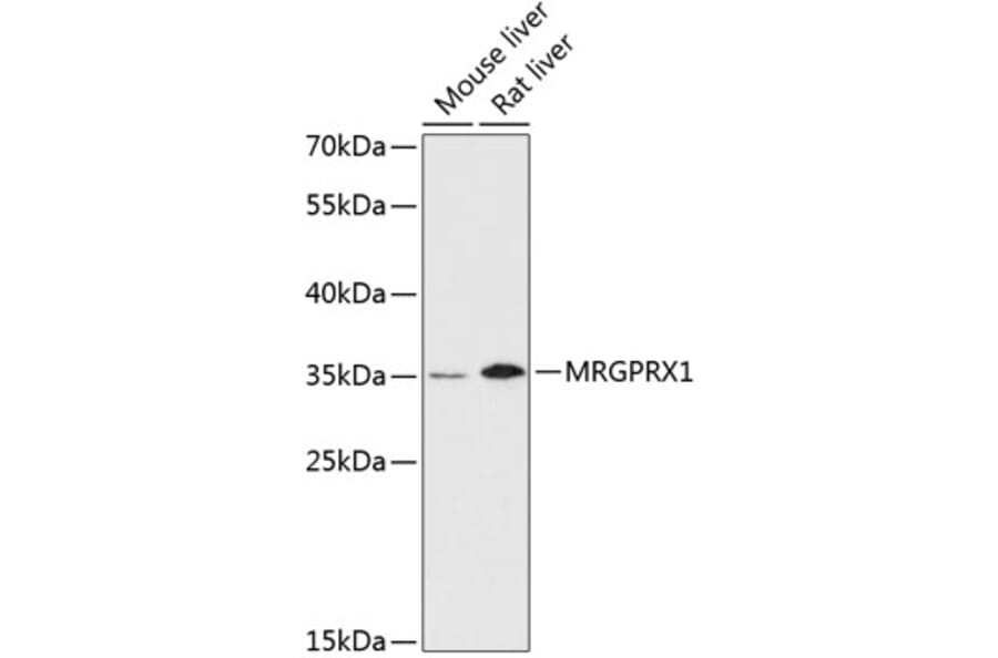 Western Blot - Anti-MRGX1 Antibody (A89492) - Antibodies.com