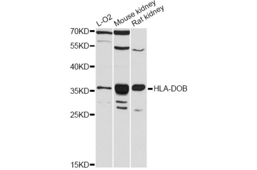 Western Blot - Anti-HLA-DOB Antibody (A12263) - Antibodies.com