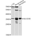 Western Blot - Anti-HLA-DOB Antibody (A12263) - Antibodies.com