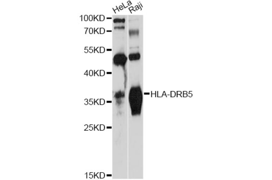 Western Blot - Anti-HLA-DRB5 Antibody (A12729) - Antibodies.com