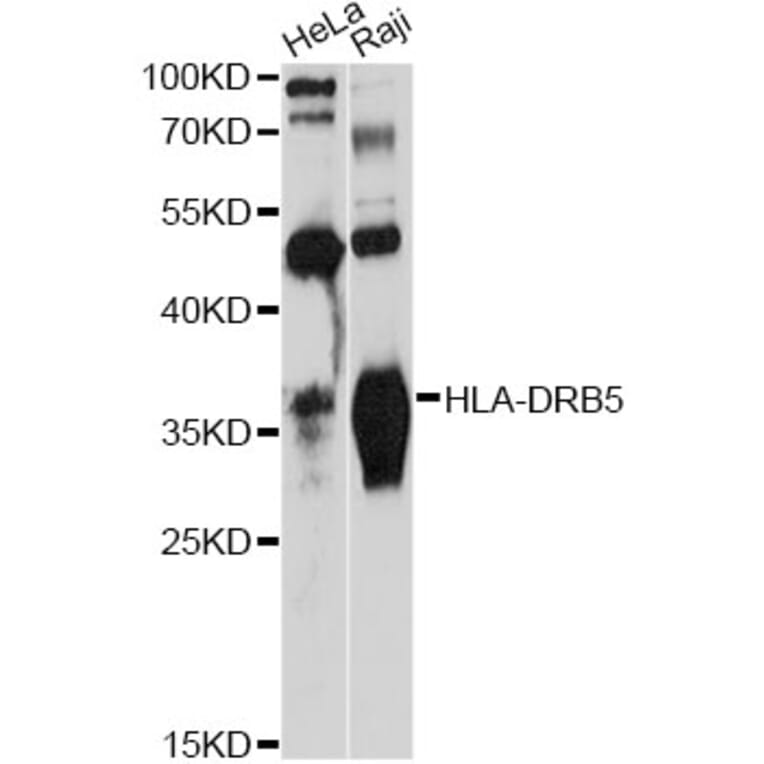 Western Blot - Anti-HLA-DRB5 Antibody (A12729) - Antibodies.com