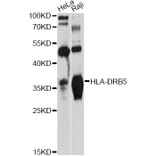 Western Blot - Anti-HLA-DRB5 Antibody (A12729) - Antibodies.com