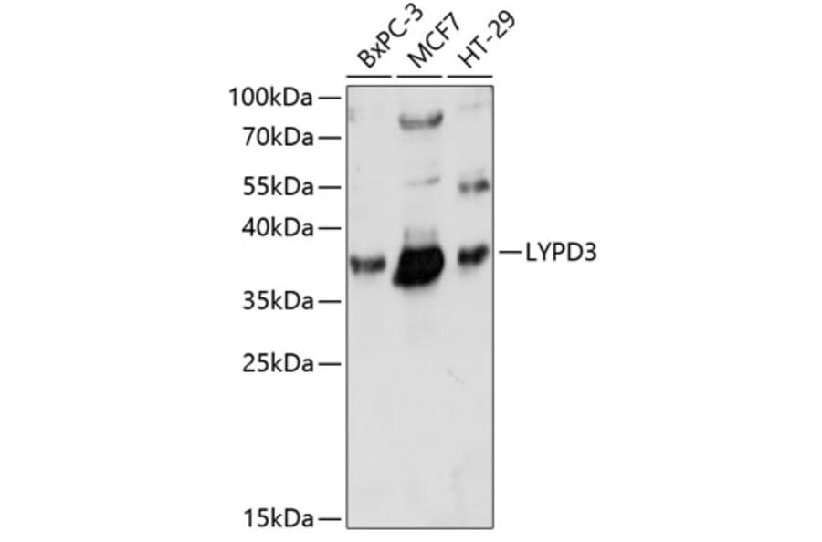 Western Blot - Anti-LYPD3 Antibody (A89495) - Antibodies.com