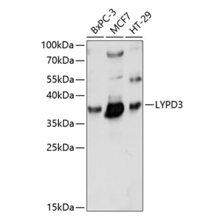 Western Blot - Anti-LYPD3 Antibody (A89495) - Antibodies.com