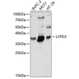 Western Blot - Anti-LYPD3 Antibody (A89495) - Antibodies.com