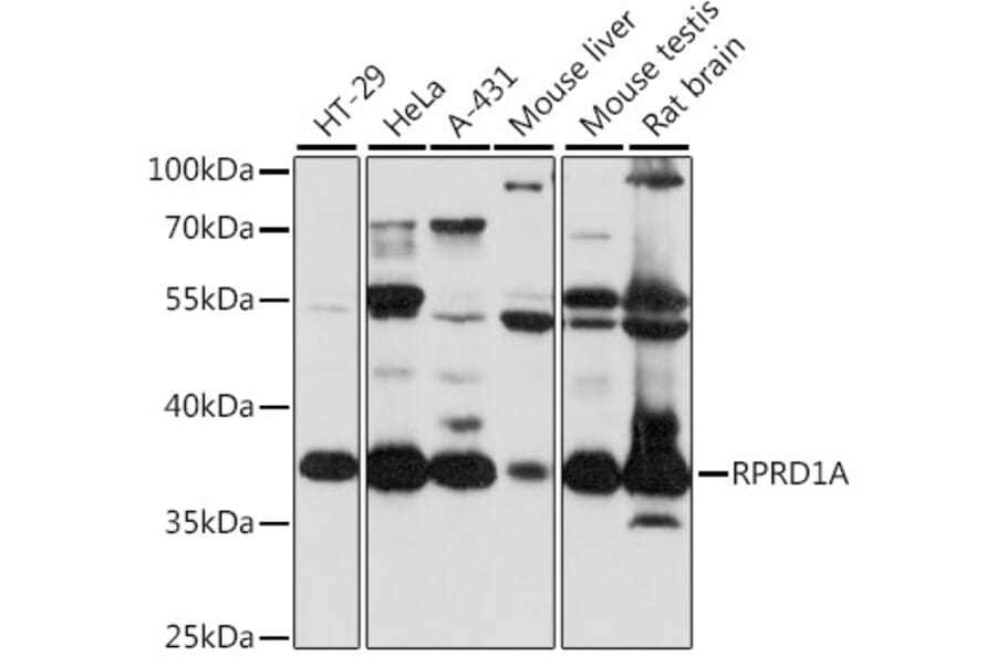 Western Blot - Anti-P15RS Antibody (A89496) - Antibodies.com