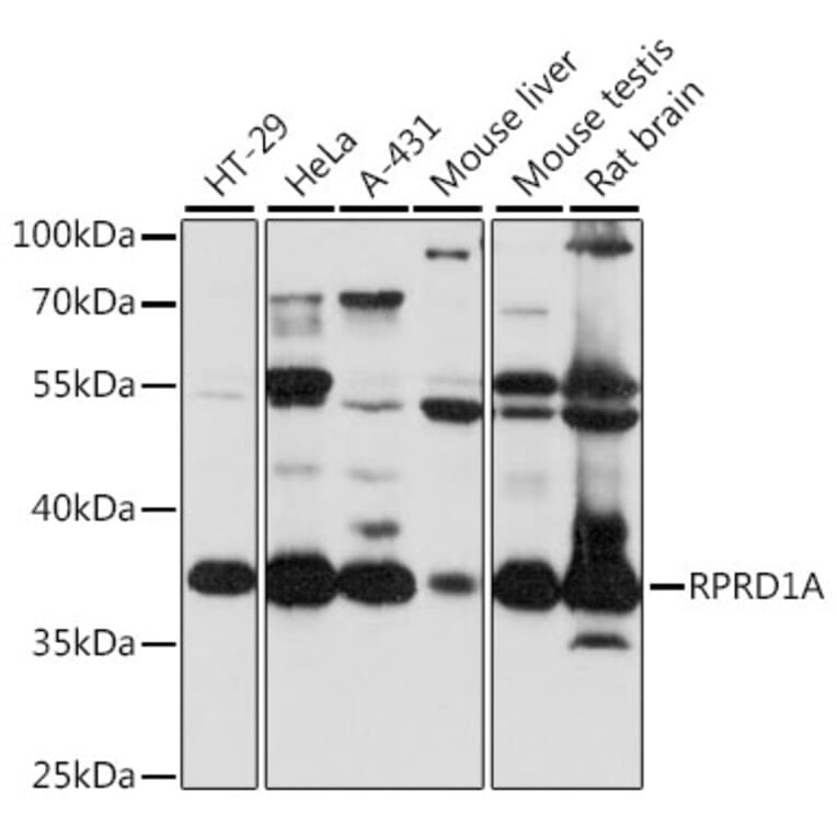 Western Blot - Anti-P15RS Antibody (A89496) - Antibodies.com