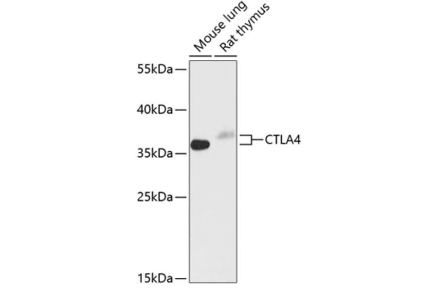 Western Blot - Anti-CTLA4 Antibody (A89497) - Antibodies.com