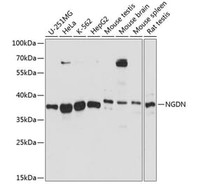 Western Blot - Anti-NGDN Antibody (A89498) - Antibodies.com