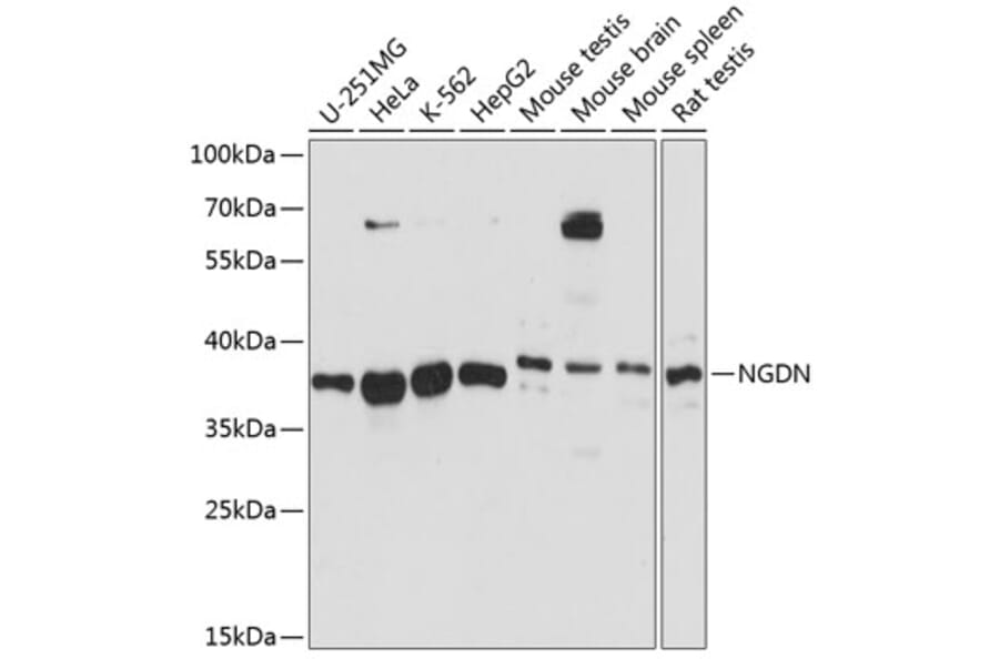 Western Blot - Anti-NGDN Antibody (A89498) - Antibodies.com