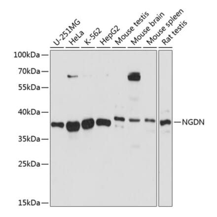 Western Blot - Anti-NGDN Antibody (A89498) - Antibodies.com