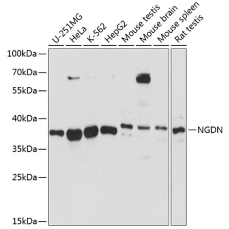 Western Blot - Anti-NGDN Antibody (A89498) - Antibodies.com